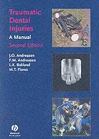 Traumatic Dental Injuries: A Manual, 2nd Edition