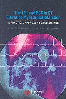 The 12 Lead ECG in ST Elevation Myocardial Infarction: A Practical Approcah