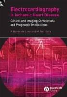 Electrocardiography in Ischemic Heart Disease: Clinical and Imaging Correla