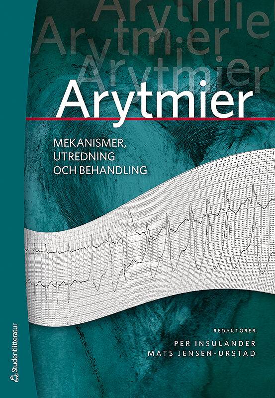 Arytmier - - mekanismer, utredning och behandling