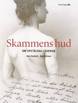 Skammens hud : om spetälska i Sverige