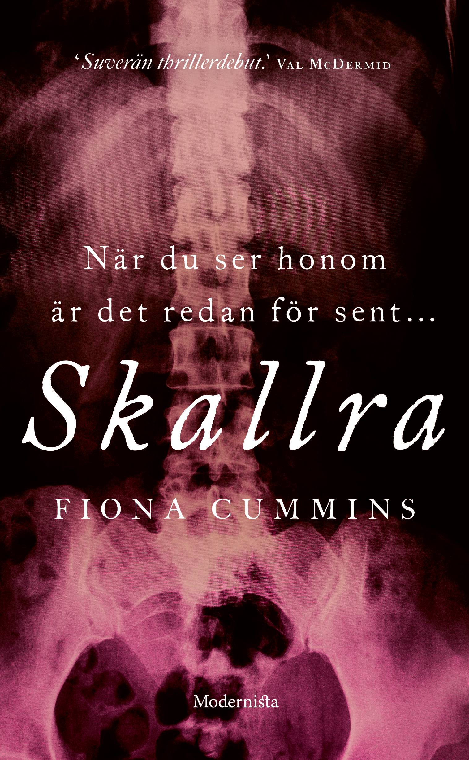 Skallra