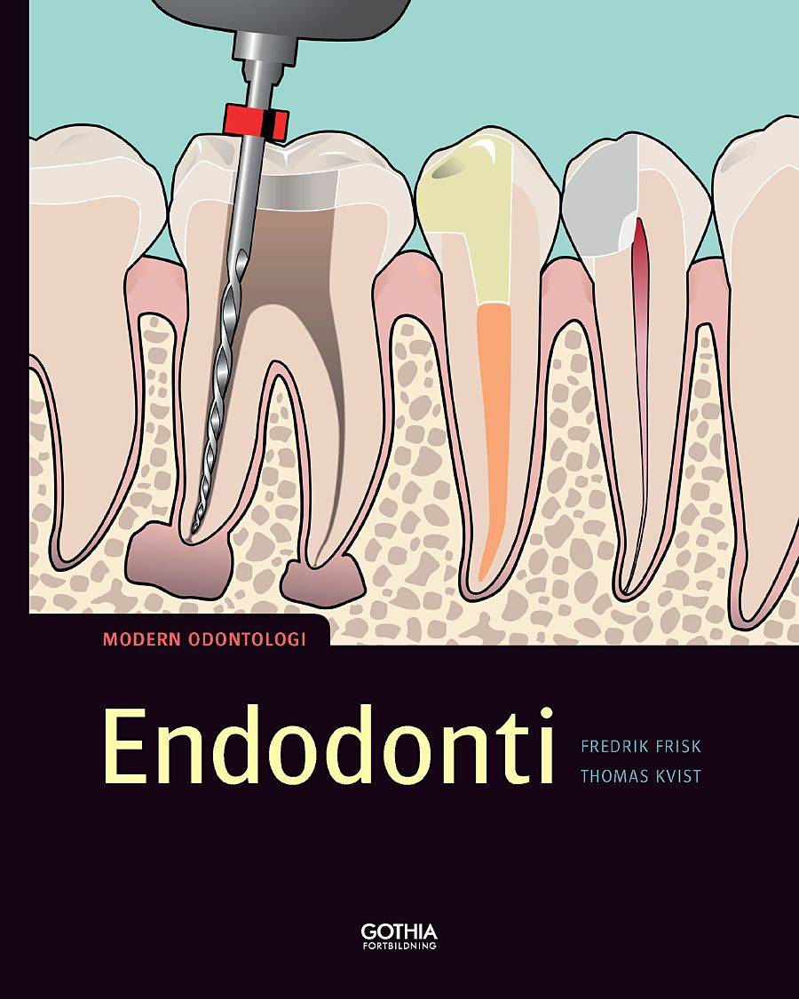 Endodonti