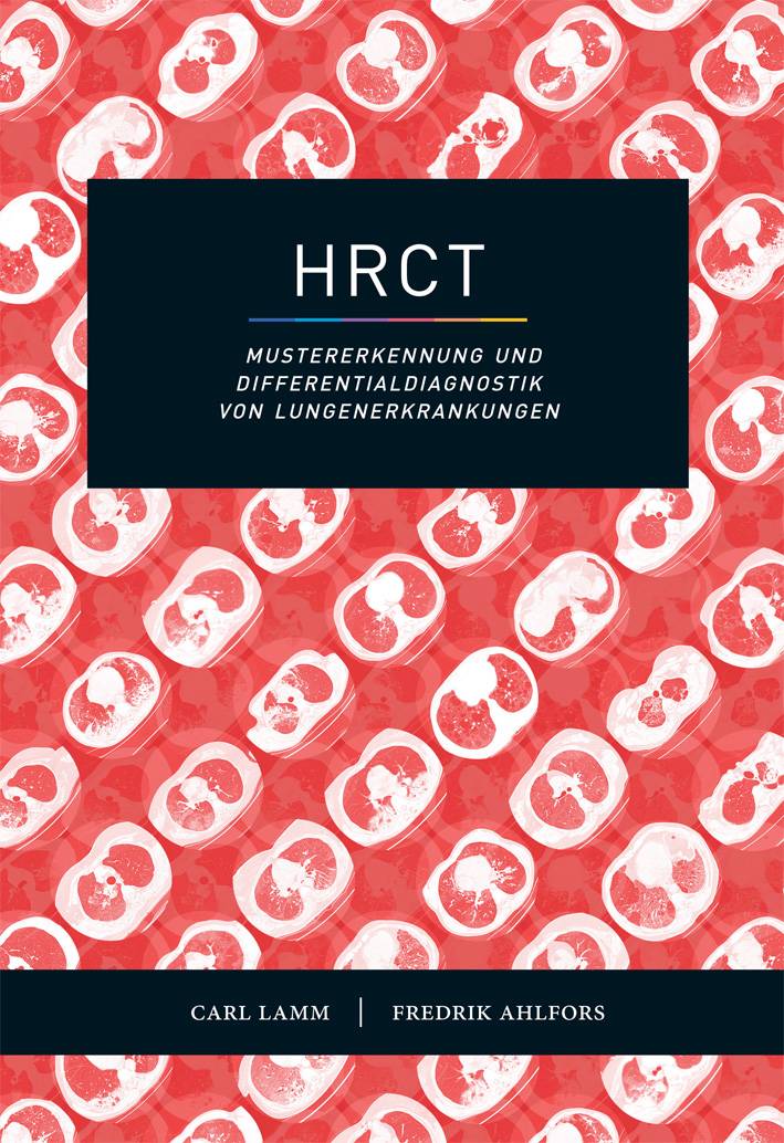HRCT – Mustererkennung und Differentialdiagnostik von Lungenerkrankungen