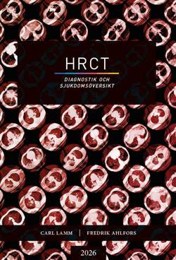 HRCT : diagnostik och sjukdomsöversikt
