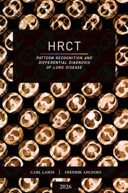 HRCT : pattern recognition and differential diagnosis of lung disease